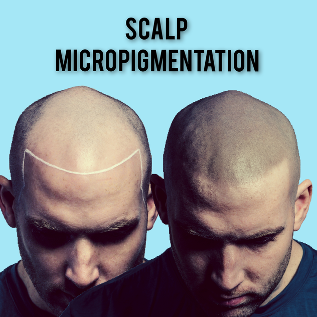Canberra's leading Scalp Micropigmentation clinic - very profitable, low hours